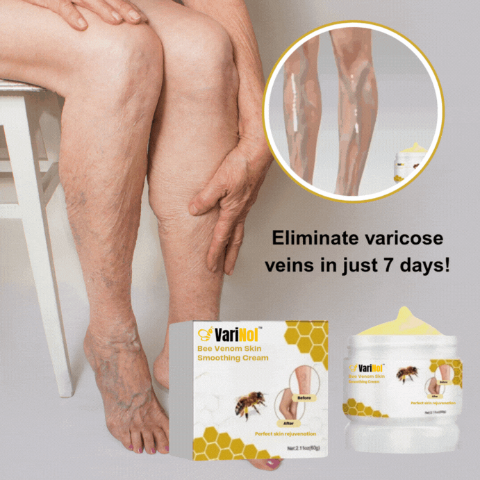 VariNol™ crème tegen spataderen | Weg met spataderen in slechts 7 dagen!