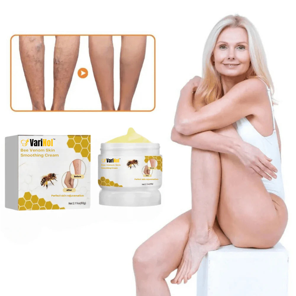 VariNol™ crème tegen spataderen | Weg met spataderen in slechts 7 dagen!