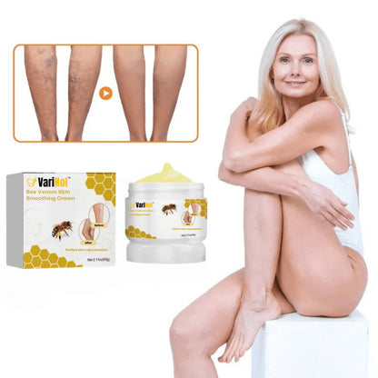 VariNol™ crème tegen spataderen | Weg met spataderen in slechts 7 dagen!