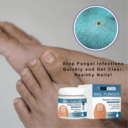 Nailvanta™ Nagel Schimmel Zalf | Stop schimmelinfecties snel en krijg heldere, gezonde nagels!